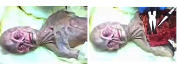 Russian Alien Autopsy