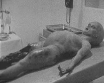 Santilli Roswell Alien Autopsy